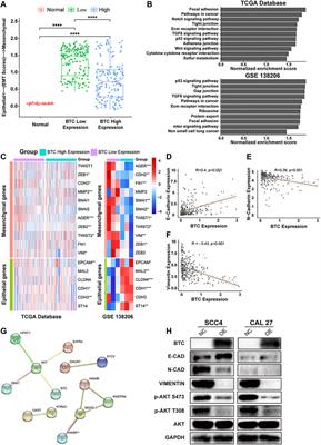 BTC as a Novel Biomarker Contributing to EMT via the PI3K-AKT Pathway in OSCC